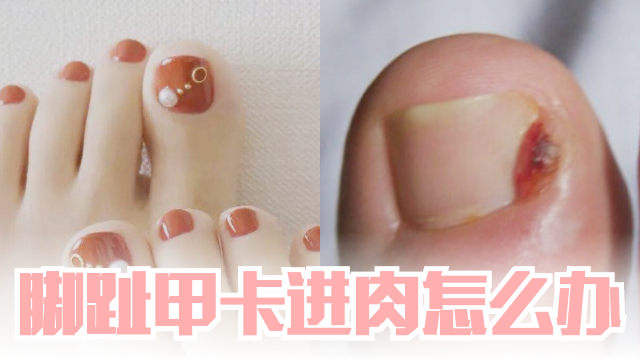toenail640-transparent.png