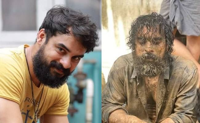tovino-thomas-meets-with-accident-admitted-to-icu-photos-pictures-stills_1.jpg