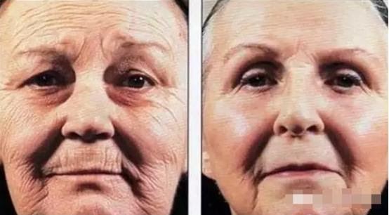 减肥失败？是因为睡不够！睡眠不足导致的5个后果！