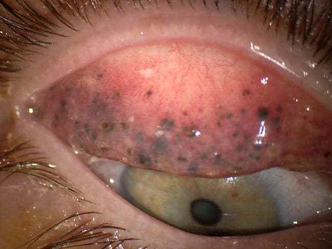 padah pakai maskara 25 tahun dan tak pernah cuci !