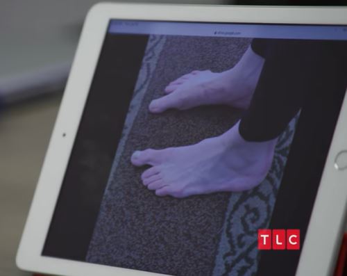 doktor terkejut lihat ibu jari kaki wanita ini besar dari biasa