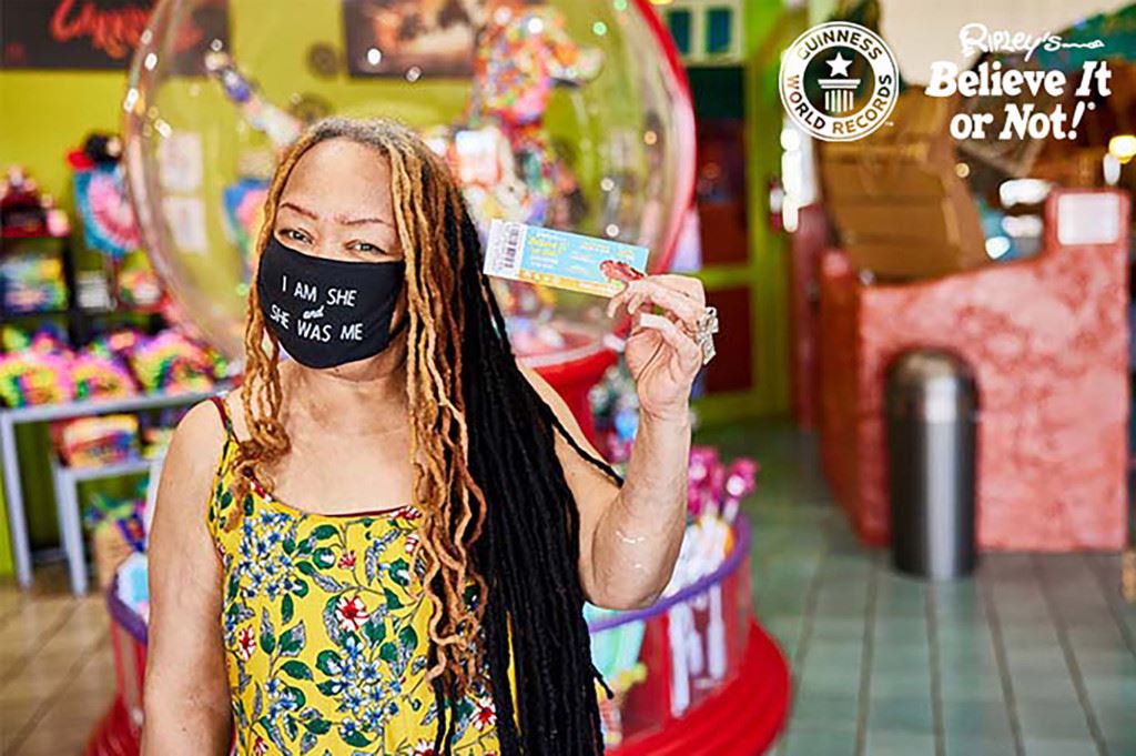 bela kuku panjang puluhan tahun, wanita ini akhirnya memotong kuku pendek