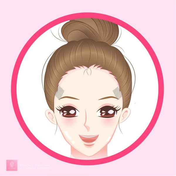 无缘无故冒痘？长痘9个位置看出身体警讯！