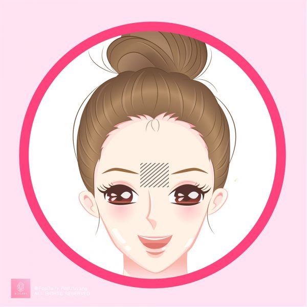 无缘无故冒痘？长痘9个位置看出身体警讯！