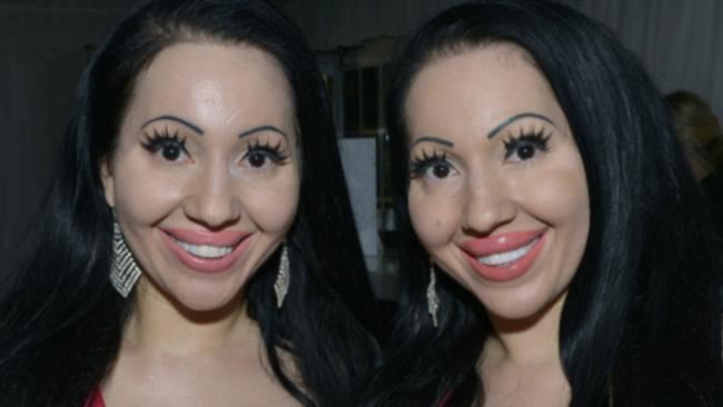 kembar paling seiras di dunia tak sanggup berpisah, sanggup kongsi teman lelaki