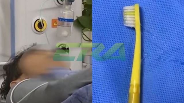 gara-gara terlalu mengantuk, lelaki tidak sedar tertelan berus gigi