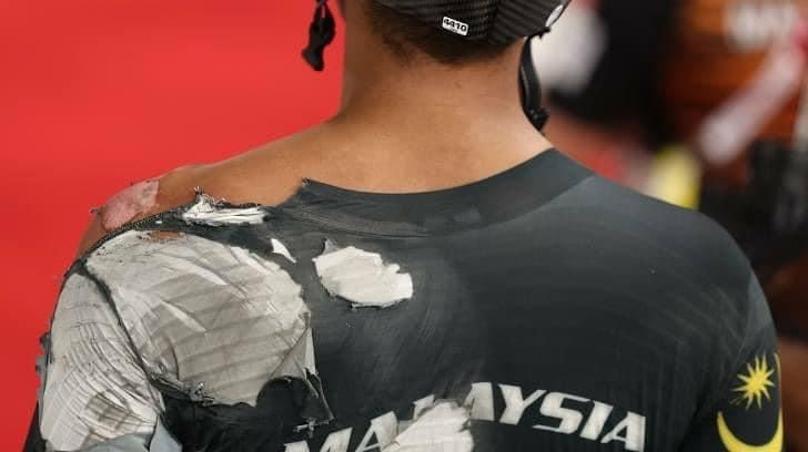 大马选手沙费道斯伤后发动态：感谢大家支持和关心