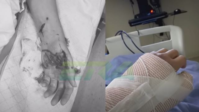 sambutan ulang tahun bertukar tragedi apabila buaya baham sebelah tangan pelatih haiwan