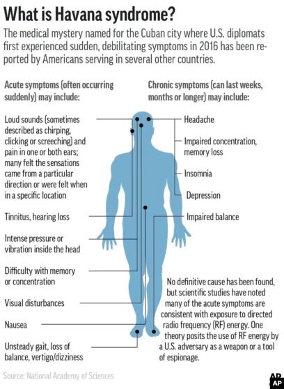 didakwa serangan senjata elektronik, as risau penyakit sindrom havana