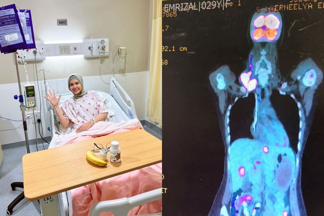 elyana kini bebas kanser selepas ‘bertarung’ hampir 11 tahun - “perjuangan dan penantian saya berhasil”