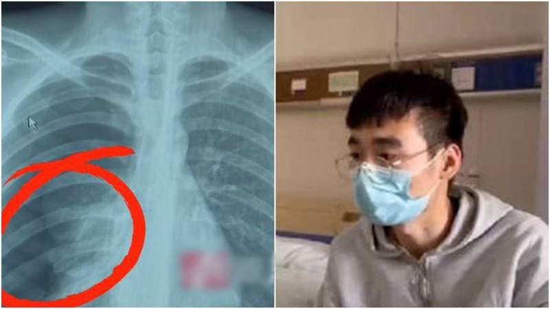 chinese man’s lung collapsed after “singing his heart out” during intense karaoke session