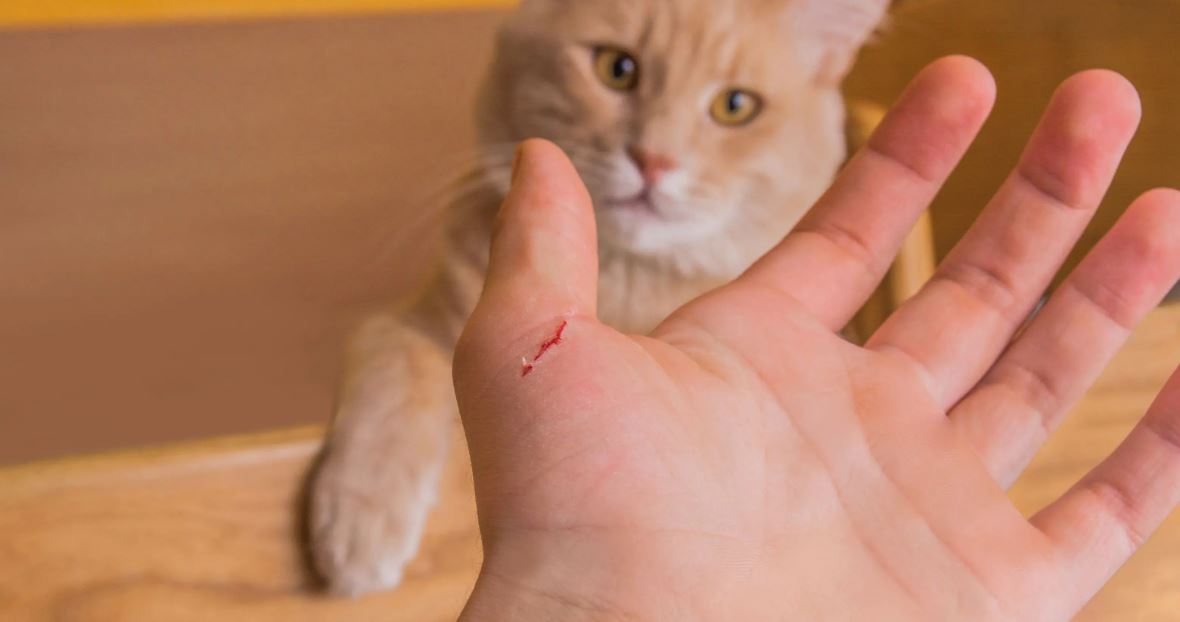 jangan abaikan kalau dicakar dan digigit kucing, ini perkara yang perlu anda tahu