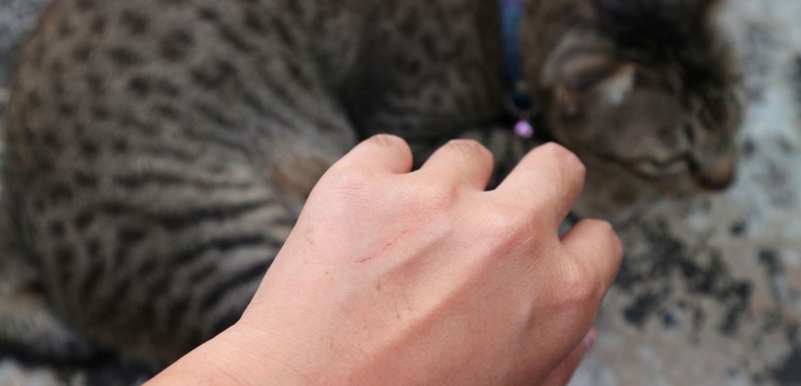 jangan abaikan kalau dicakar dan digigit kucing, ini perkara yang perlu anda tahu