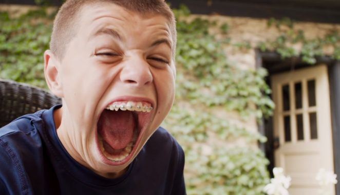 muat burger sekali masuk, remaja pegang rekod dunia bukaan mulut terbesar