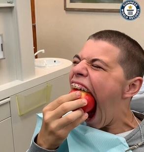 muat burger sekali masuk, remaja pegang rekod dunia bukaan mulut terbesar