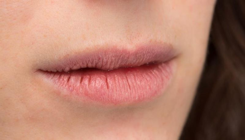 dry lips? here are some ways to relieve dry and chapped lips!