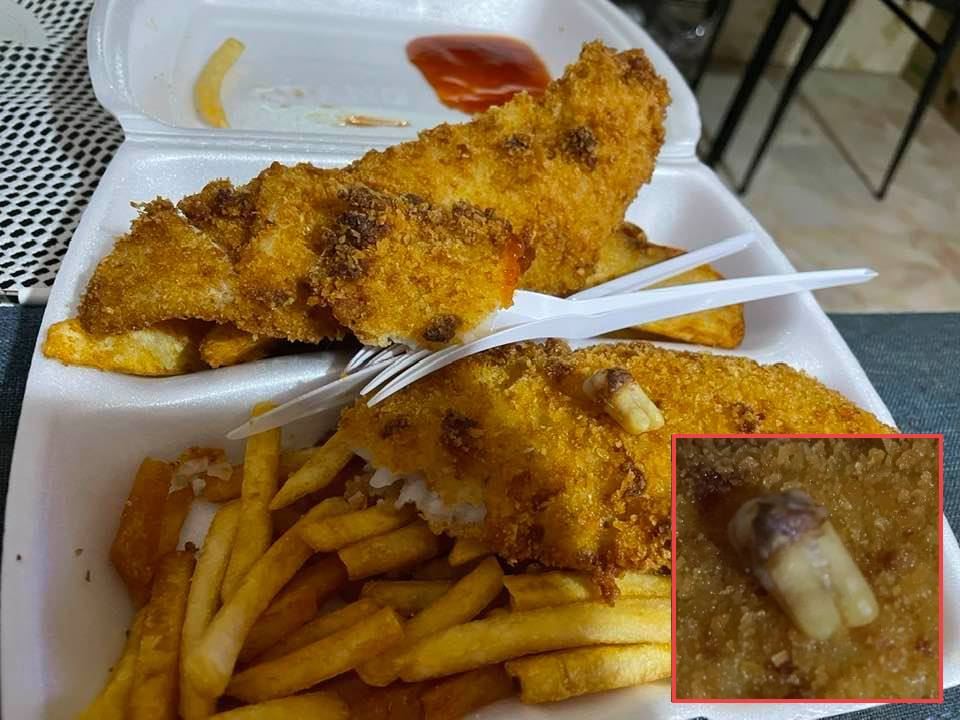 woman finds alleged human tooth in fish and chips meal 