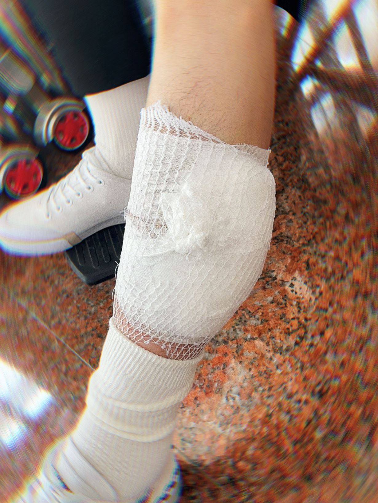 暂时退出综艺节目❗️陈立农腿部受伤：真的很痛💔