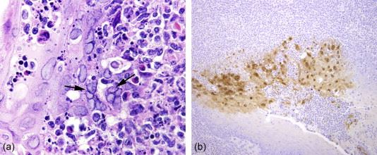 virus monkey b sebabkan kematian pertama manusia, ini yang anda perlu tahu