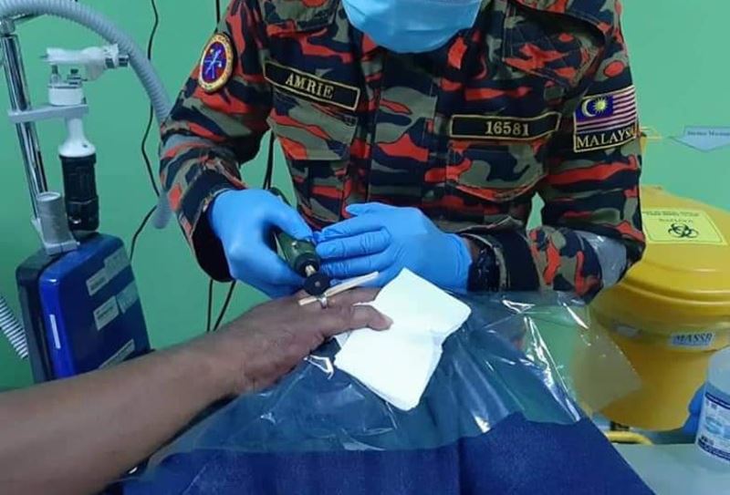 man suffered for 20 minutes as bomba helped take off ring stuck on his finger