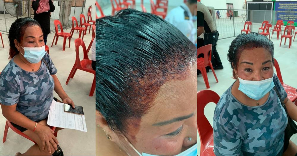 woman shows up for vaccination appointment with unfinished dyed hair!
