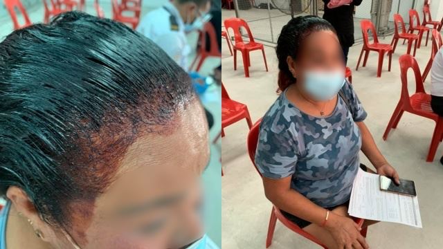 ingatkan cedera! petugas terkejut wanita datang ke ppv dengan kepala ‘berlumuran darah’