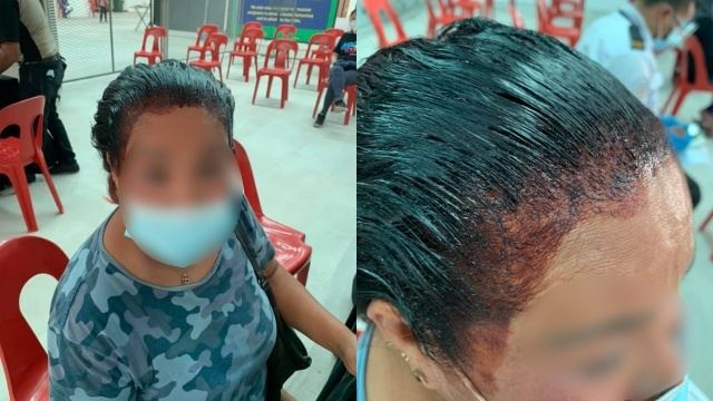 ingatkan cedera! petugas terkejut wanita datang ke ppv dengan kepala ‘berlumuran darah’