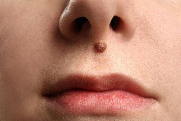 pandai berkata-kata manis dan peramah, maksud sebalik tahi lalat di bibir