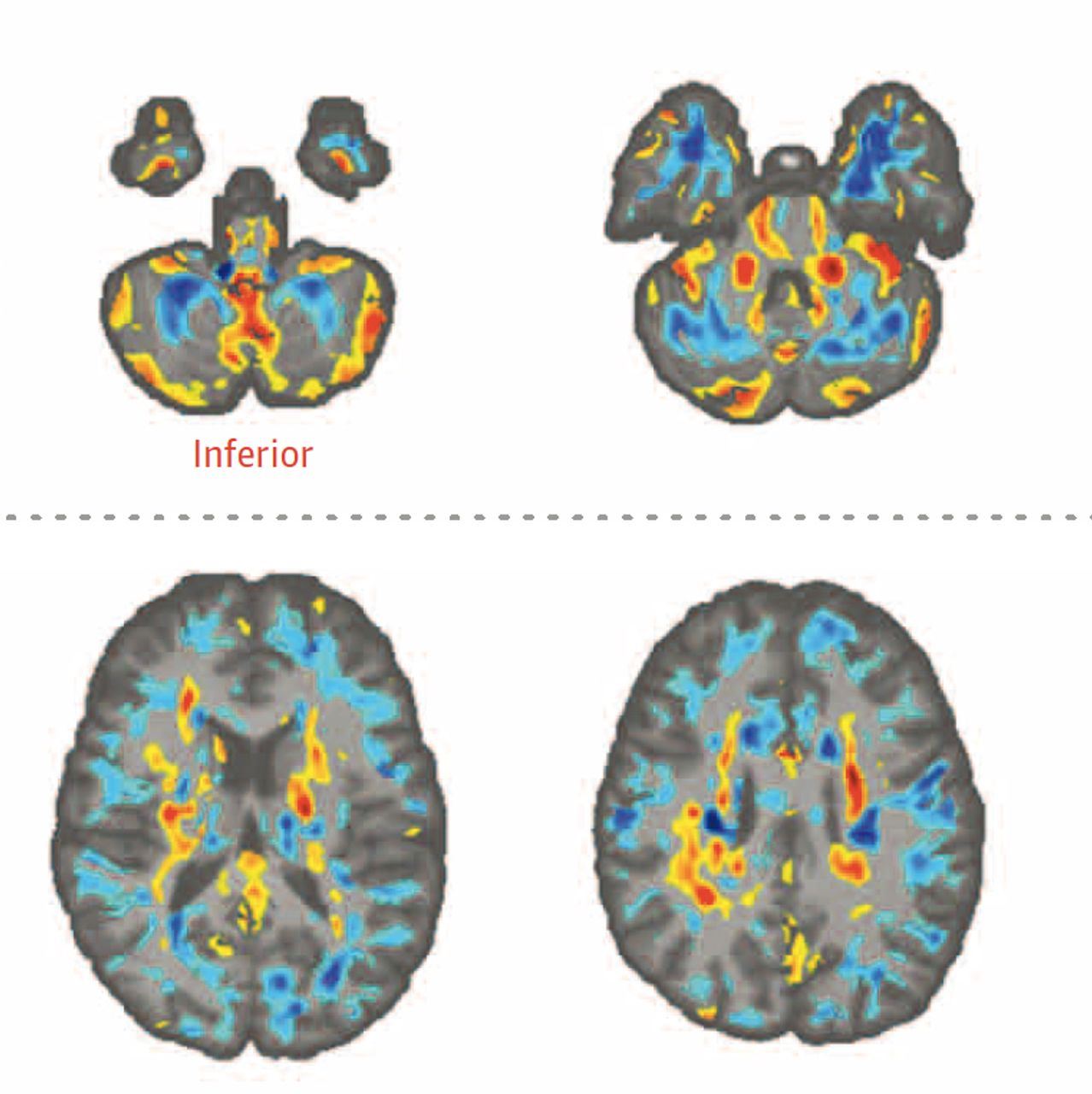 100 pegawai cia hidap sindrom havana, punca belum diketahui