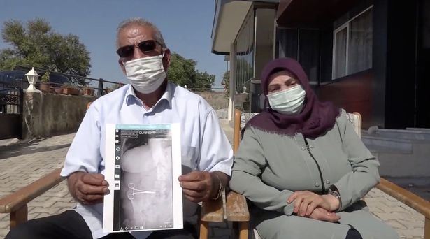 woman discovers scissors in stomach that was left behind from previous surgery