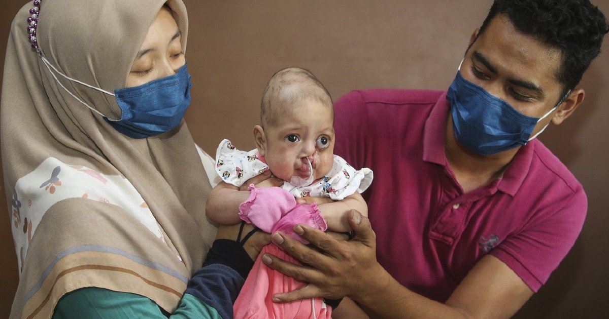 bayi 3 bulan derita otak terkeluar, keluarga tabah hadapi ujian