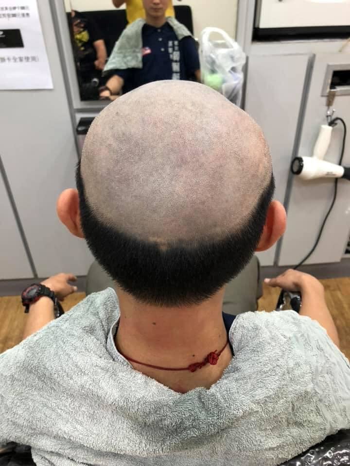 mom gives teenage son half-bald haircut to discourage him from going out during lockdown