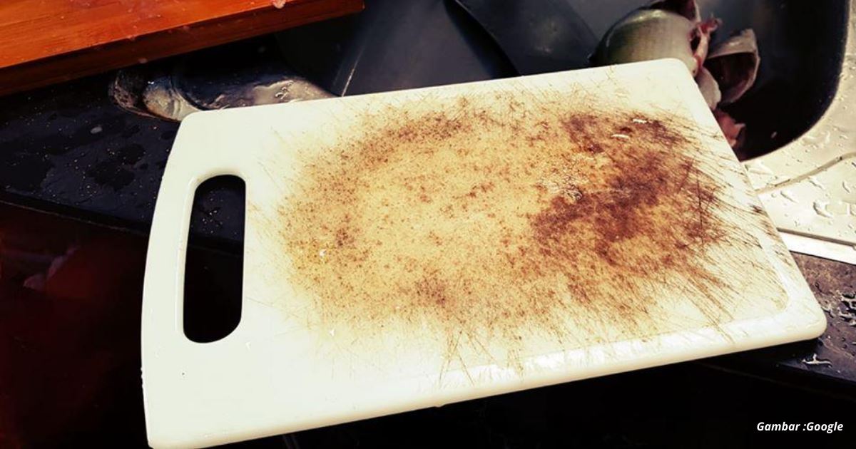 bahaya! papan pemotong punca keracunan makanan?