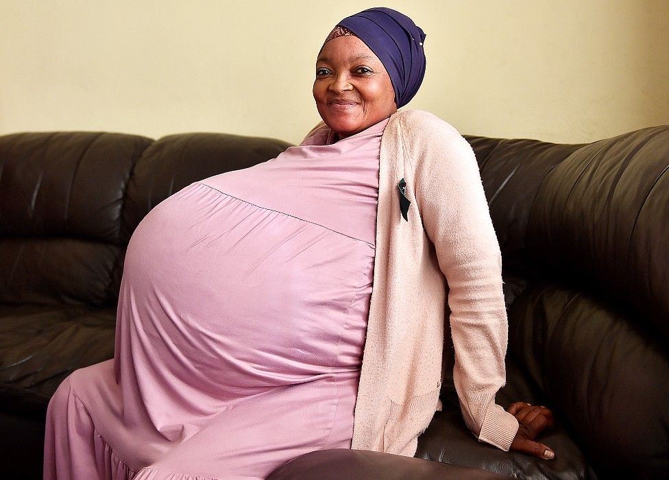 menakjubkan, ibu lahir anak kembar 10 di afrika selatan