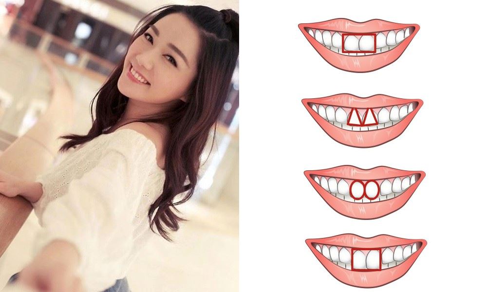 外国疯传心理测验❗️门牙形状看你的隐藏性格😁椭圆形代表小文青