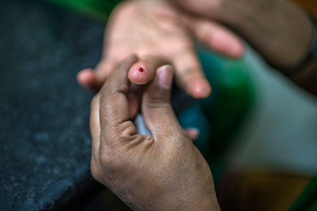 sudah jatuh ditimpa tangga, mualaf reda terima ujian kehilangan kaki akibat diabetes dan sakit jantung