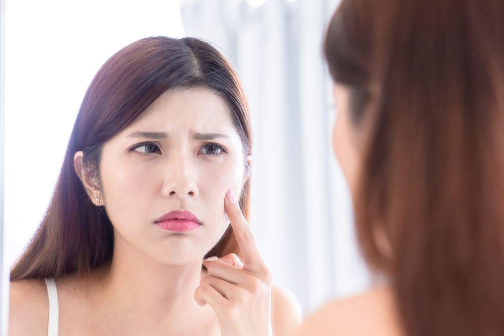 想跟脸上痘疤说bye bye？用这4样东西就对了！