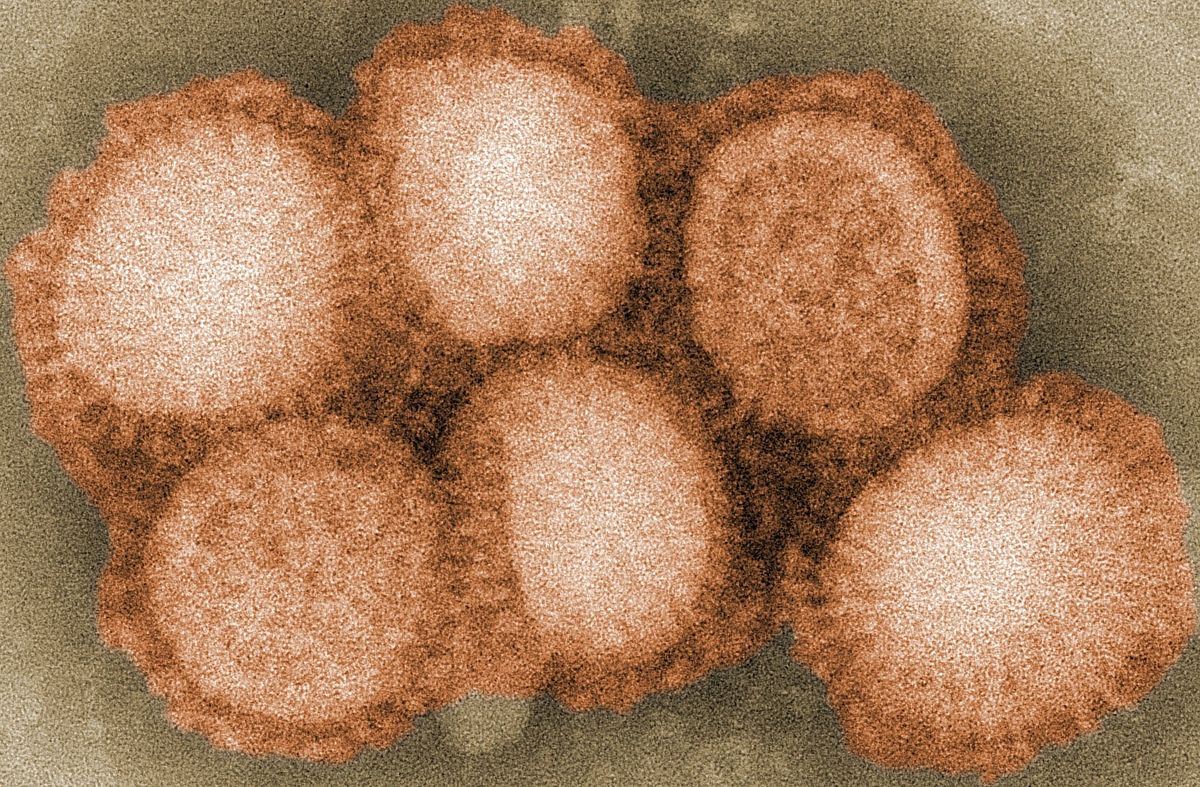 covid-19 pun belum habis, rusia dah kesan virus h5n8 jangkiti manusia