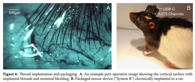 ciptaan ini benarkan anda dengar muzik terus kedalam otak