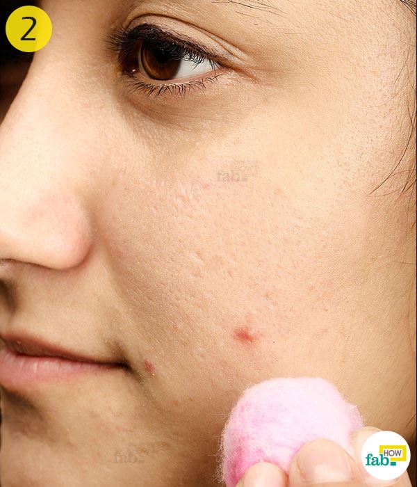 seminggu cuci muka guna air lemon, tengok kesannya!