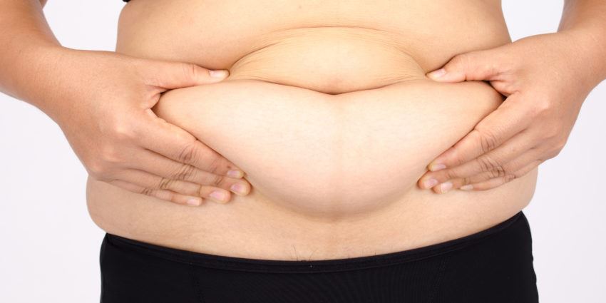 jenis-jenis perut buncit yang selalunya jadi pada perempuan