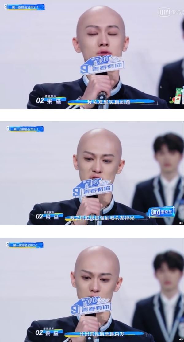 ⚠️ 梁森公开留光头的原因❗️落泪说到：压力头发掉光