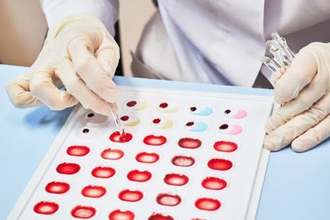 selain darah a, b, o dan ab, ada juga darah bombay. apa tu?