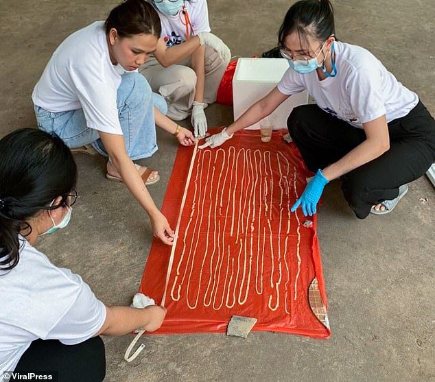 18m long tapeworm removed from man’s stomach after experiencing pain