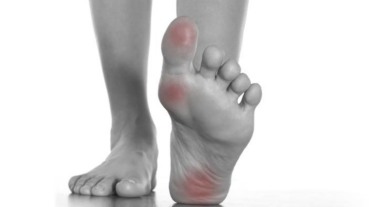 tiba-tiba rasa kebas atau semut-semut pada kaki tanda diabetes?