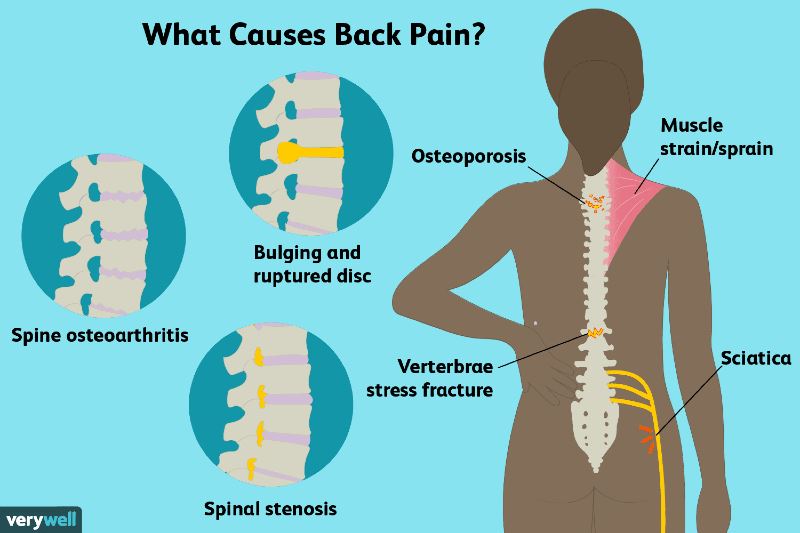 this is how you can prevent lower back pains when sitting too long!