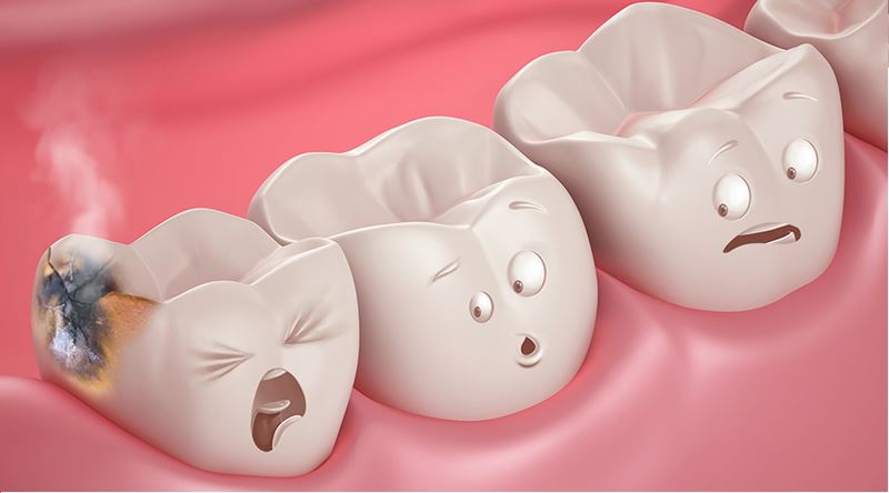 what is a cavity and how do you prevent it?