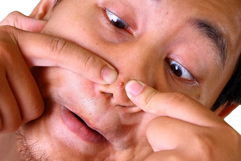 stop squeezing your pimples and pulling out your nose hairs!