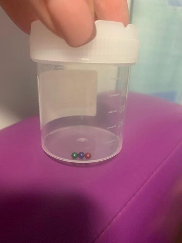 gara-gara ikut trend, budak nyaris maut tertelan magnet