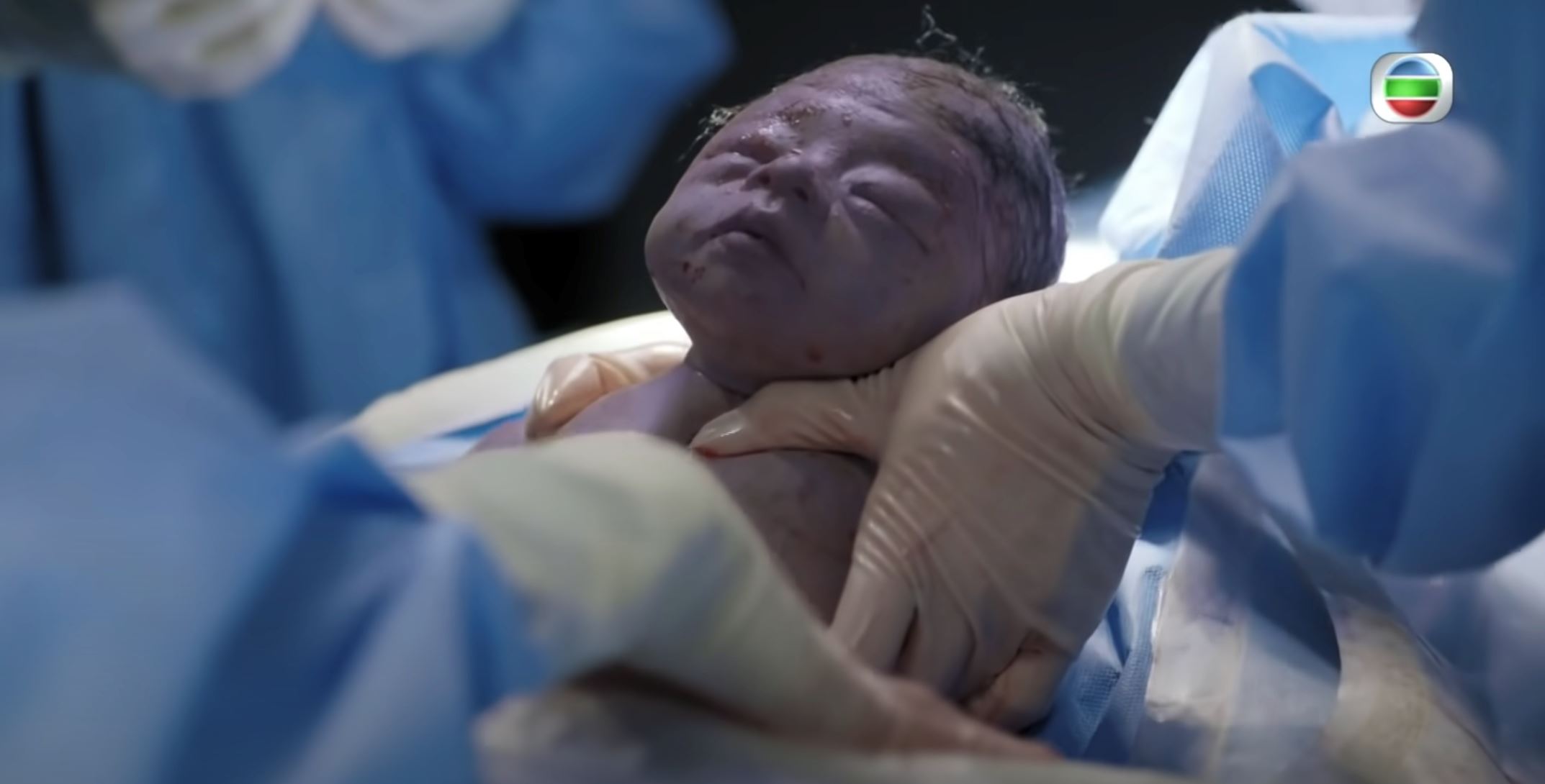 【影片】《星空下的仁医》郑嘉颖抢救钟嘉欣母子大晒演技❗️宝宝道具造价达5位数🔥